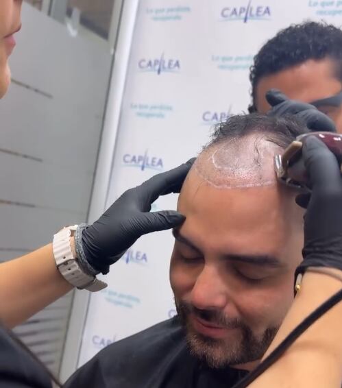 Diego Bravo se sometió este miércoles a un nuevo tratamiento estético que atacará de una vez por todas un complejo que ha tenido toda su vida.