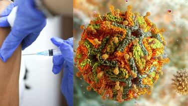 Ministerio de Salud echa para atrás obligatoriedad de vacuna contra la fiebre amarilla, ¿por qué?