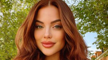 Laura Ortega pide con urgencia donadores de sangre para un ser muy especial