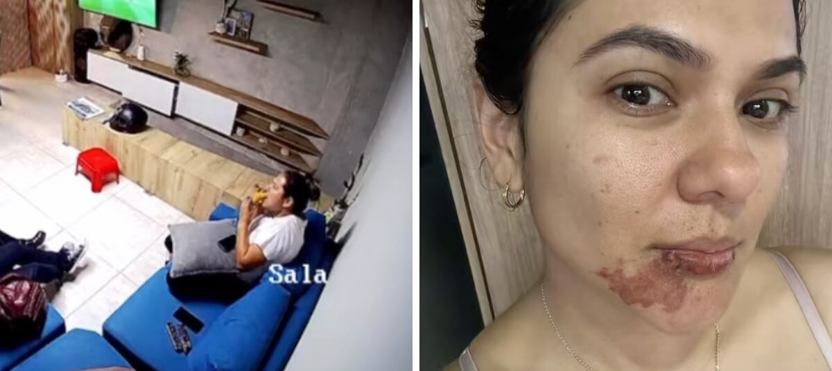 A Nataly Rubio le explotó una empanada. Foto: El Tiempo