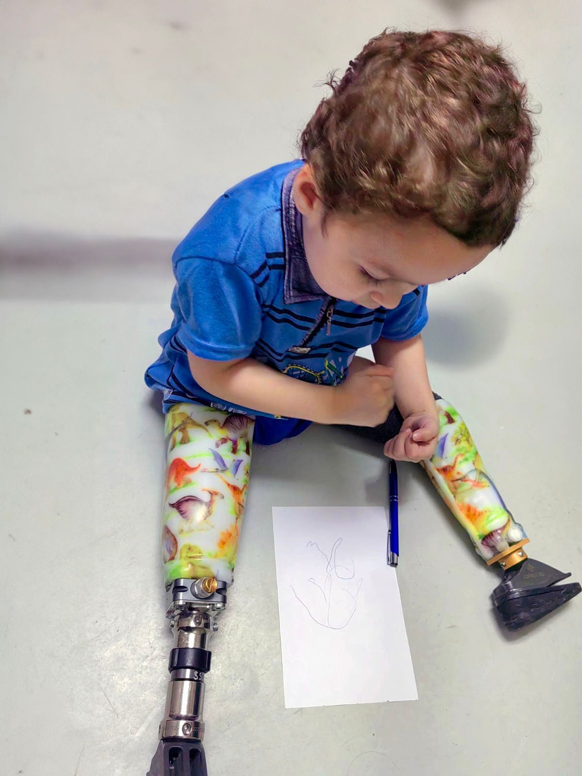 Fausto es un niño de cuatro años al que le amputaron las piernas, pero ya da sus primeros pasos