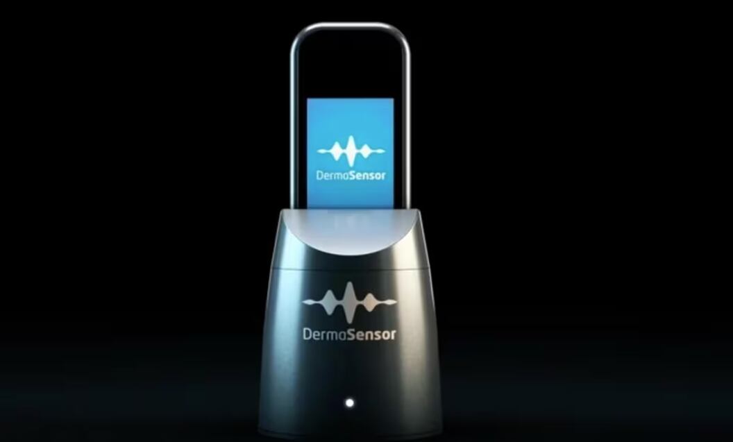 DermoSensor