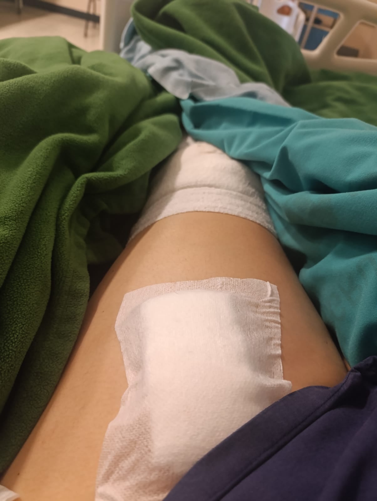 Ángeles Morales, modelo talla plus, quien tuvo el accidente por el Juan Pablo II.