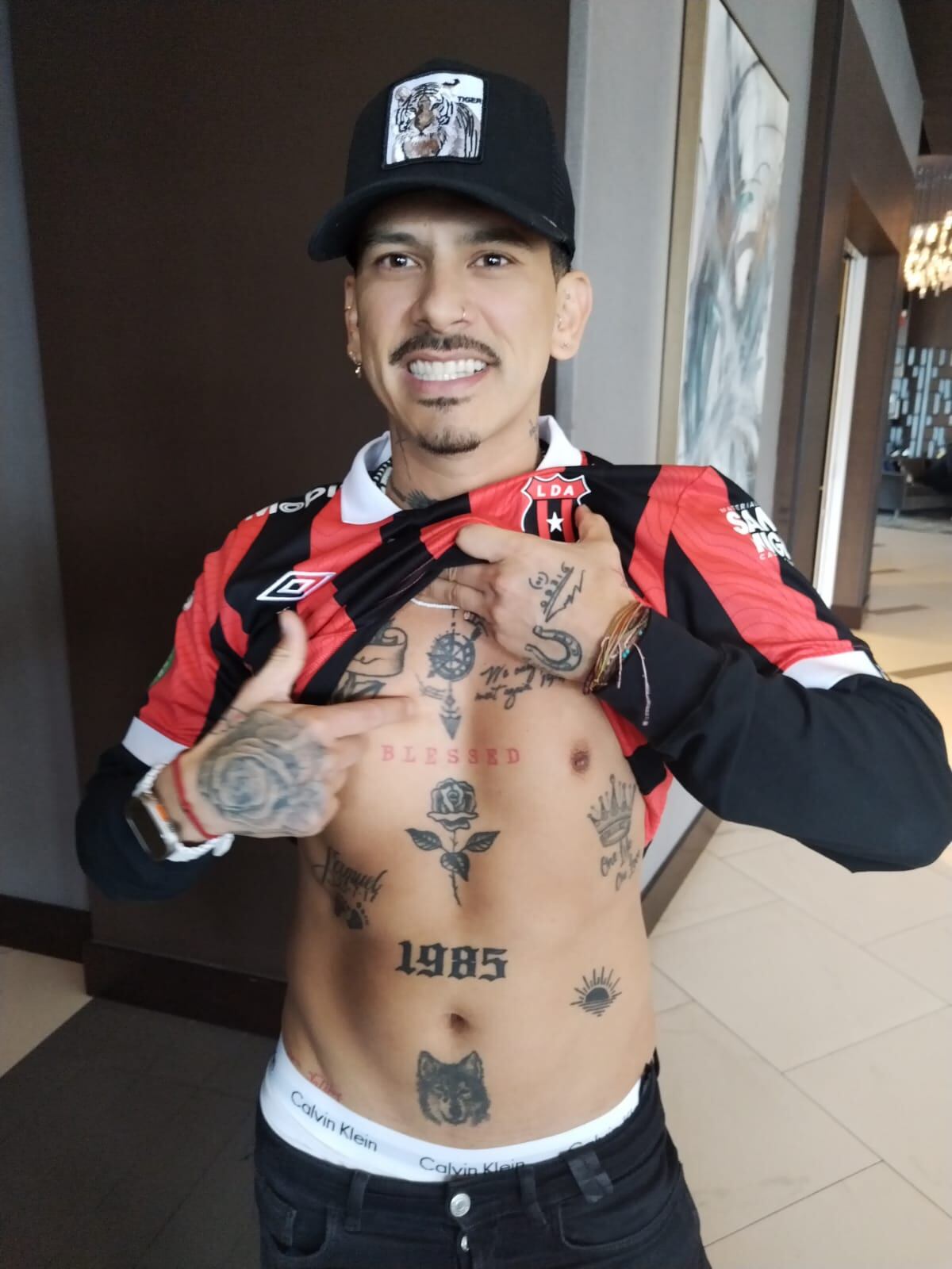 Herson Torres Cabezas, sobreviviente de tres balazos para robarle un celular. Vive en Manhattan