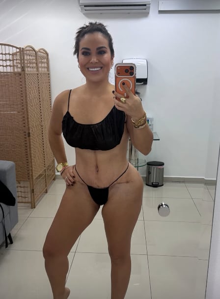 Natalia Romano, hermana de Choché Romano, mostró como va su recuperación y los resultados de su cirugía.