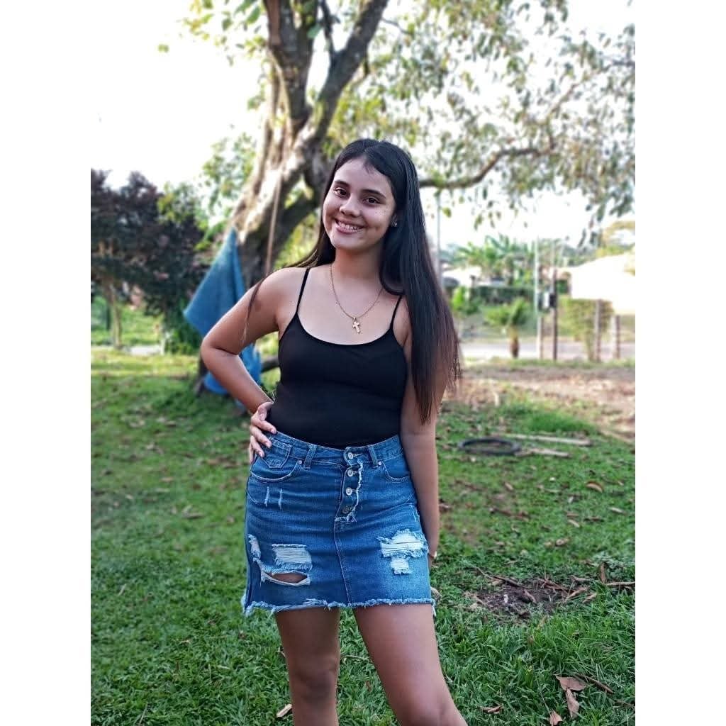 Clara Camille Real 17 años sufre desde hace 5 años las secuelas de un grave accidente