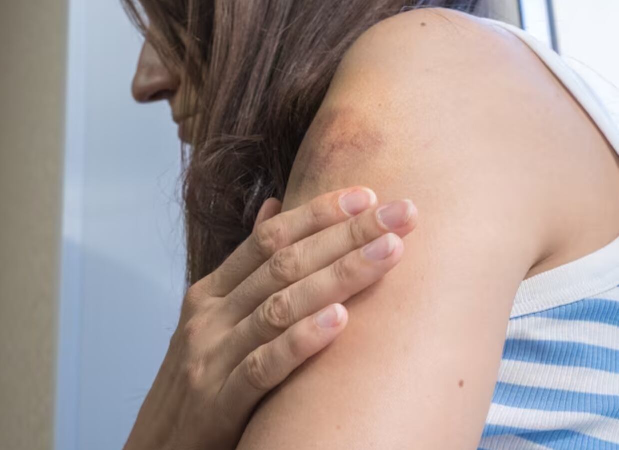 Violencia contra la mujer