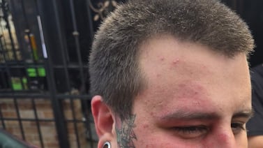 Joven que fue a comprar pizza para esposa embarazada denuncia brutal agresión por supuestos miembros de la Ultra