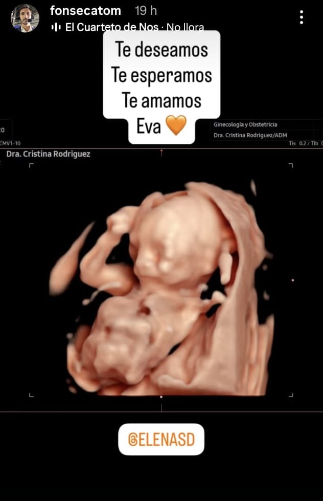 Tomás Fonseca,