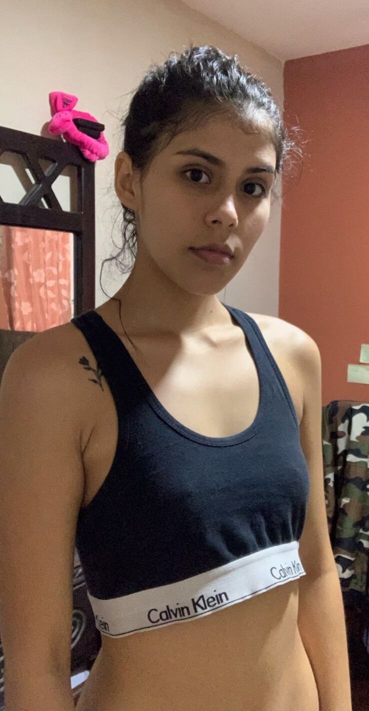 Nahomy Baltodano Ruiz, en el 2020, con 17 años, luchó contra la anorexia nerviosa y pasó de 70 kilos a 45, terminó internada en el Psiquiátrico y hasta sintió la muerte, pero logró superar su trastorno alimenticio.