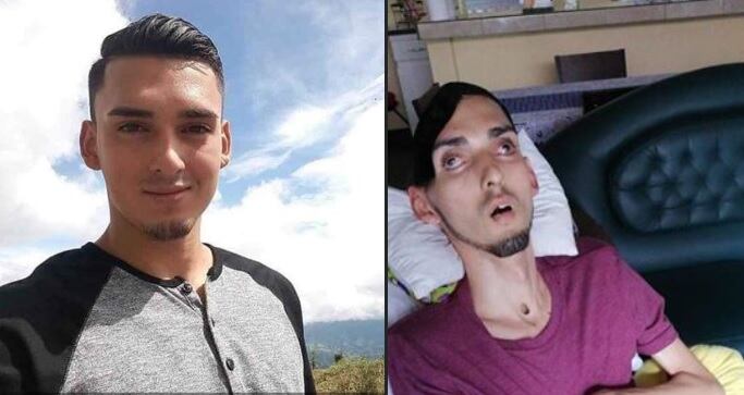 Alejandro Solano, joven que quedó en cama por accidente de tránsito que sufrió en junio del 2018. Foto tomada de Facebook.