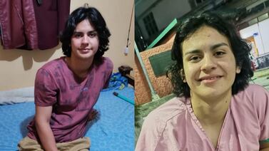 Joven sobreviviente de balacera que fue amputado: “Ahora sí voy a poder tener una vida”