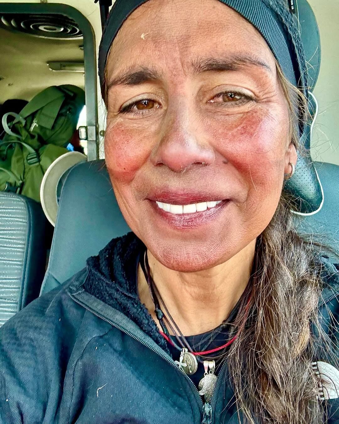 Así lucía Ligia Madrigal luego de subir el Everest.