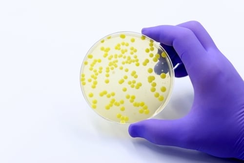 Cultivo de bacterias en una placa de Petri en un laboratorio de microbiología, simbolizando la historia y el avance de la microbiología en la salud pública.