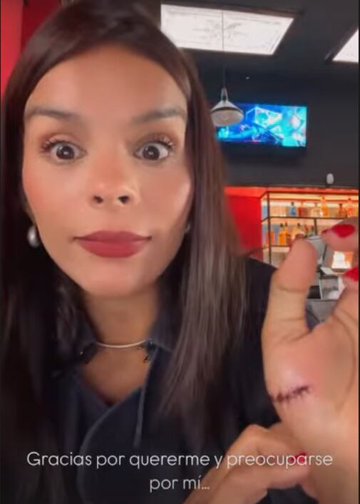 Lucía Frei sufrió un accidente hogareño que la mandó al hospital.