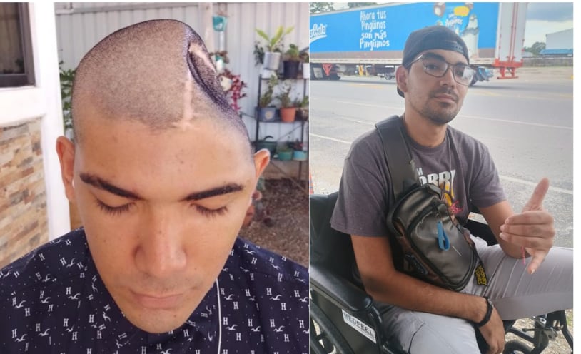 Daniel Durán Quesada sobreviviente de accidente ha mejorado mucho