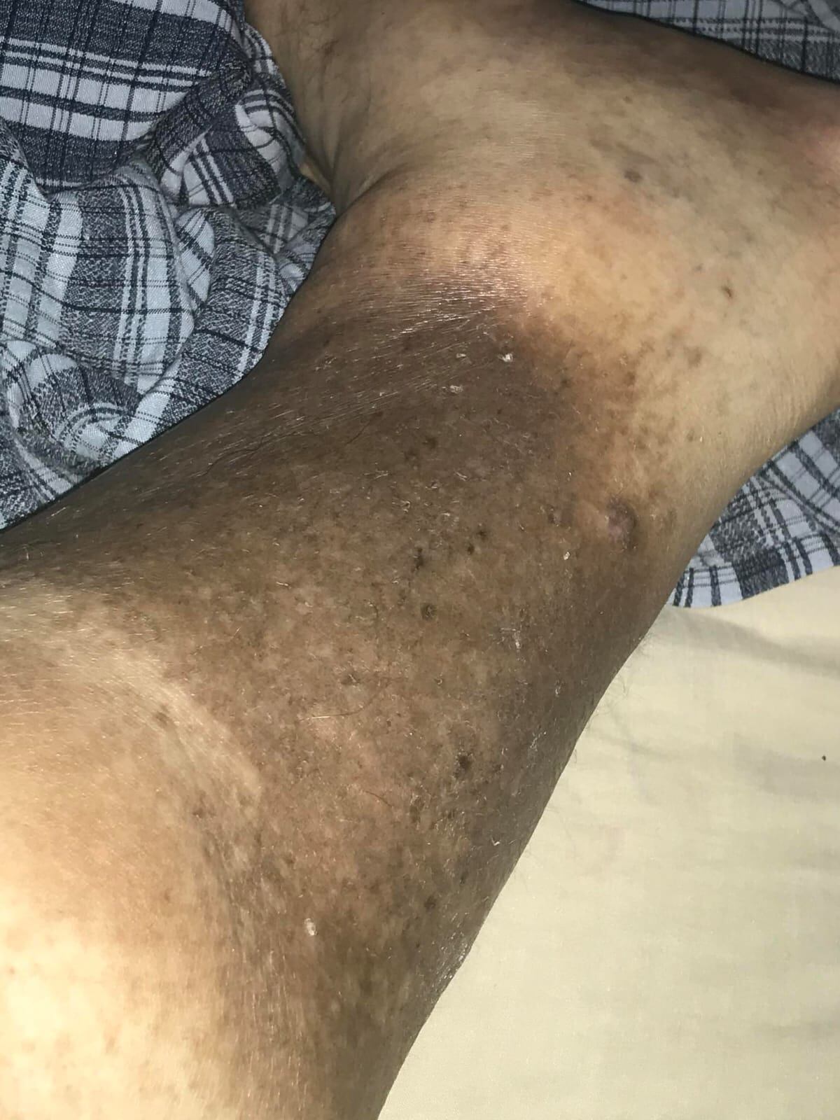 Alex Blanco es un vecino de Purral de Goicoechea que desde niño ha luchado contra la obesidad.