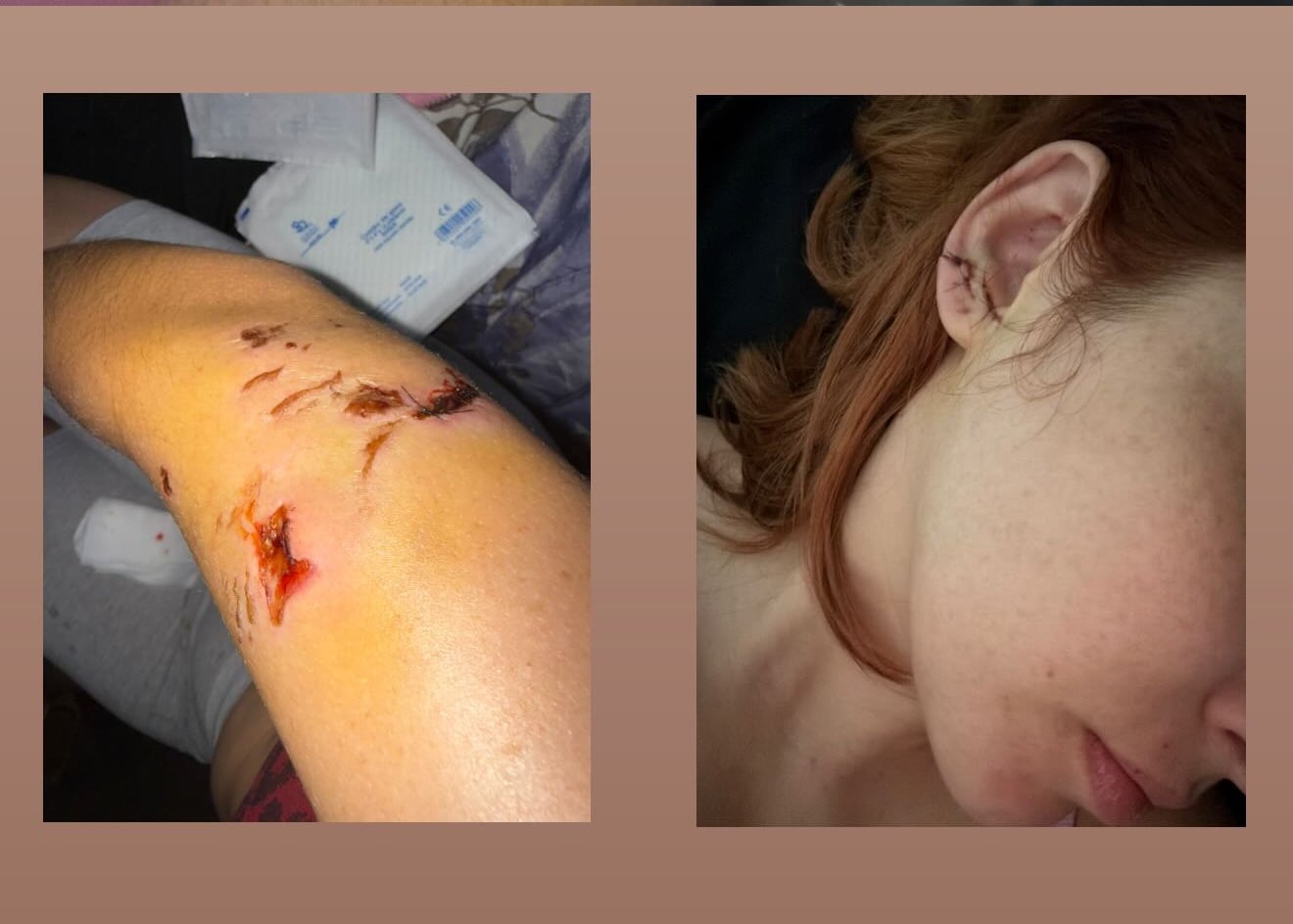 Andreína Méndez, bailarina costarricense.