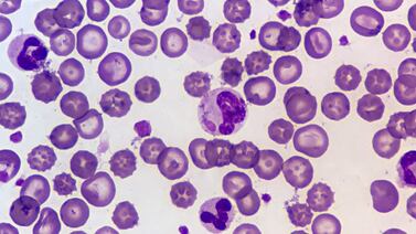 ¿Qué es distemper? La mortal enfermedad que, aparentemente, se propaga entre los perros ticos