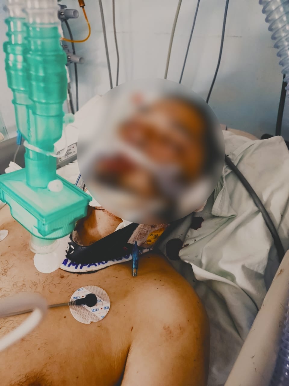 Wilker Morales, joven atropellado en San Rafael Arriba de Desamparados. Foto cortesía Rodrigo Morales.