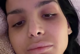 Nicole Roper, hija de Lynda Díaz, pide oraciones tras enfrentar una nueva infección