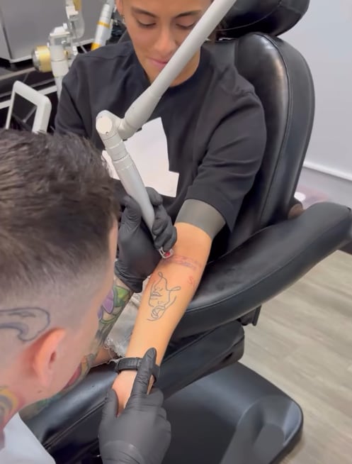 Fabiola Villalobos se quita tatuajes.