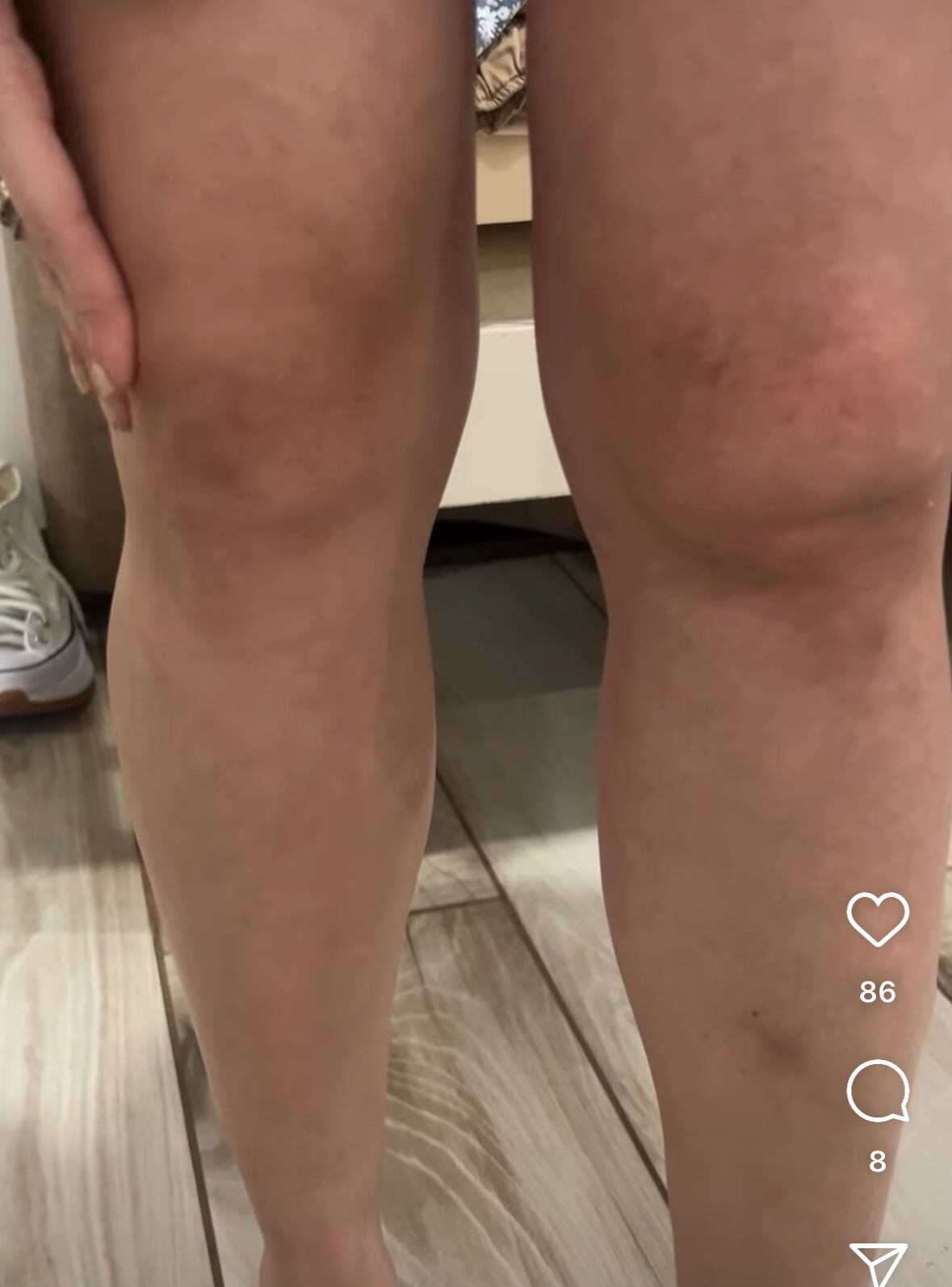 accidente de stefanny Baldí