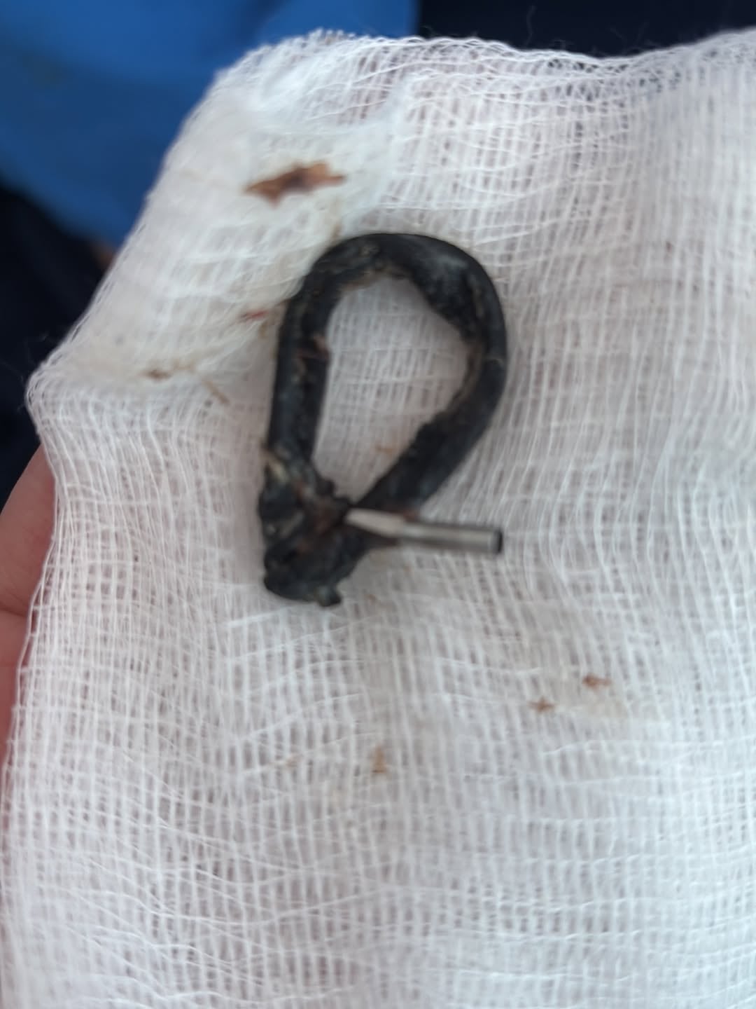 Federico "Kiko" Robles ya fue operado