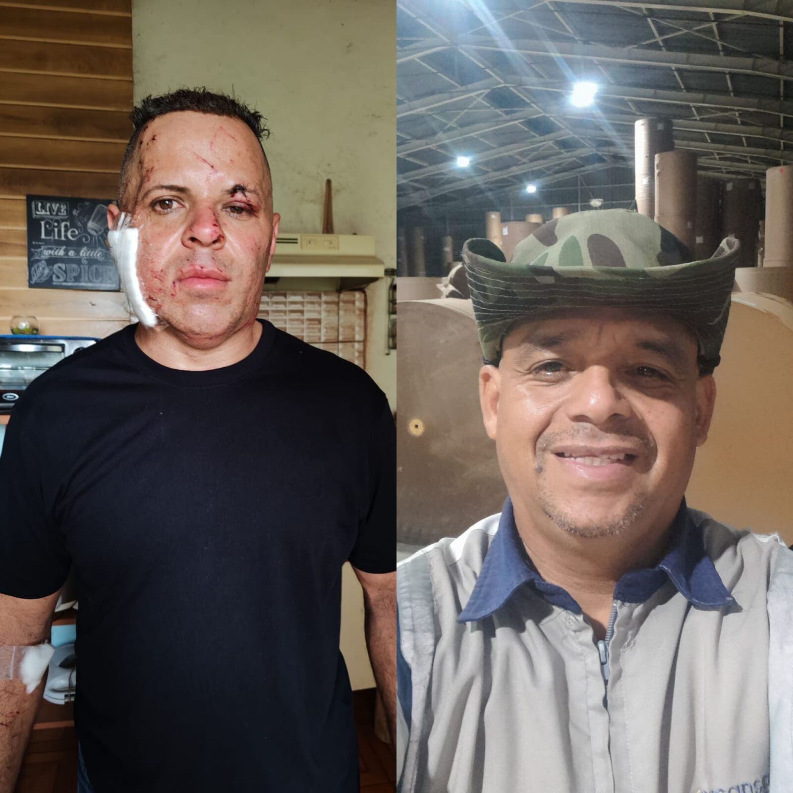 Carlos Alberto Seas Martínez cumplió este domingo 4 de agosto un mes de haber estado a un hilo de la muerte, luego de que el cabezal que manejaba quedara totalmente destruido al ser aplastado por un contenedor. Foto: Alberto Seas para La Teja