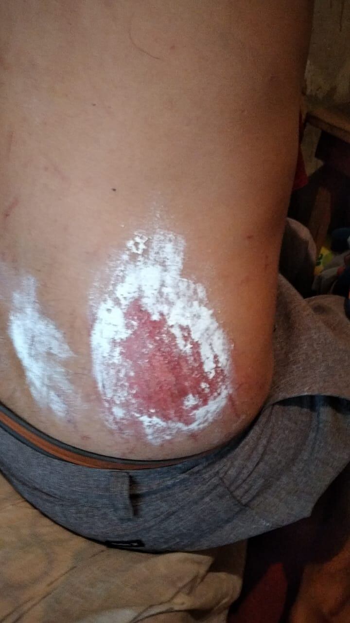 José Antonio Picado, de 31 años fue rescatado con vida, él ruega para que sigan buscando a su hermano Isaac, de 24 años en una minería en Las Juntas de Abangares, Guanacaste. Foto: José Antonio Picado para La Teja