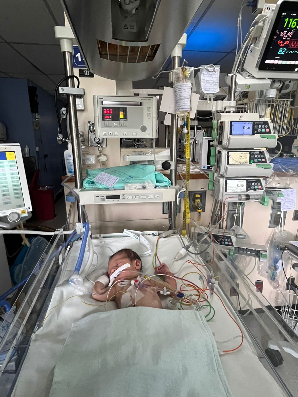 Zoe es una niña de 9 meses que viajará a España para que le hagan una operación a corazón abierto