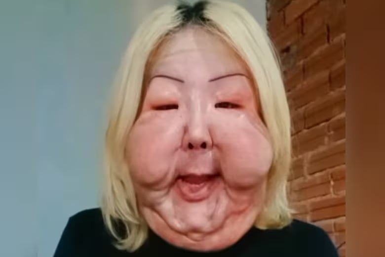 Juliana Oliveira inició cirugías reconstructivas tras sufrir una mala praxis en 2017.