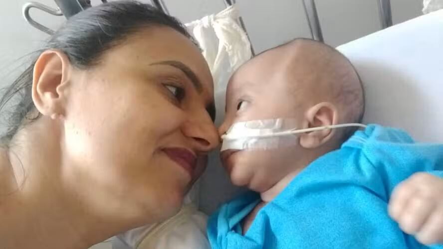 Una madre adoptiva cuenta cómo la vida le cambió al acoger a un bebé con hidrocefalia, quien le dio cinco años de felicidad.