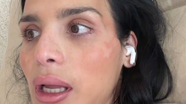 Coco Roper sufre horrible accidente de tránsito: así están ella y su hija Ellie