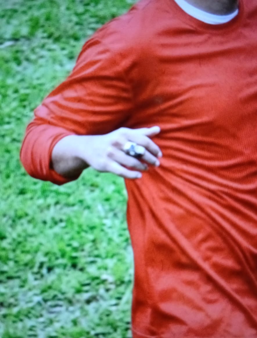 Un partido de fútbol de la categoría Sub-17 terminó convirtiéndose en una pesadilla para Marvin Ceciliano, al ser golpeado en la cara, desde el 2000 ejerce como árbitro y esta es la primera vez que enfrenta un momento grave por esta pasión. Foto: Marvin Ceciliano para La Teja