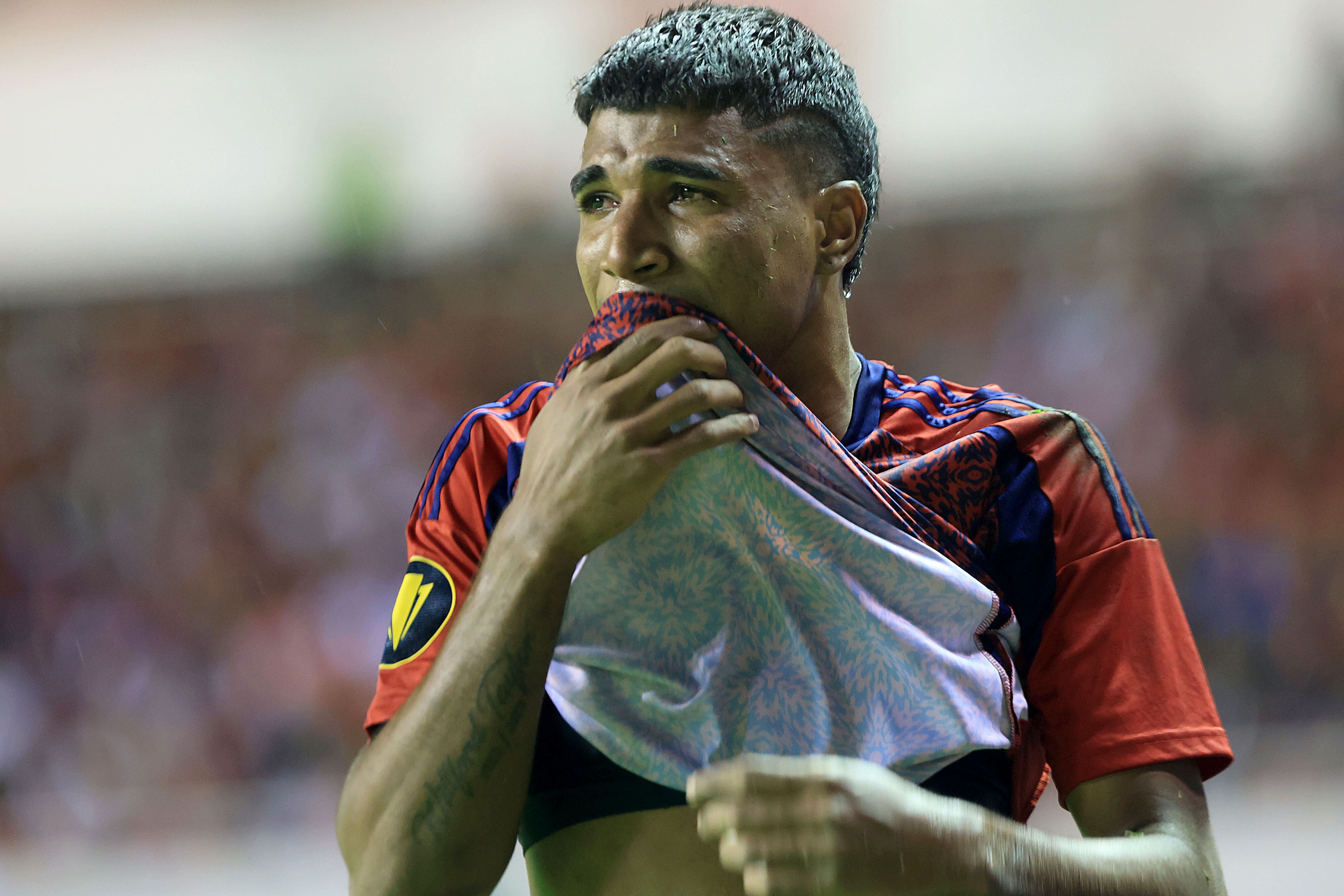 Costa Rica vs. Belice