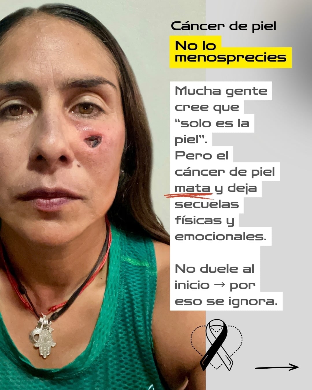 Ligia Madrigal, primera tica en llegar al Monte Everest luchó contra el cáncer de piel.