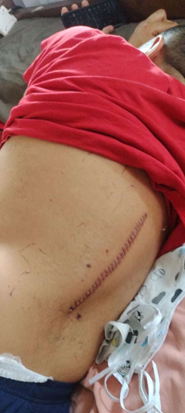 Miguel Josué Ramirez, एक DJ जो मार्ग 27 वर एका जीवघेण्या अपघातात वाचला होता, त्याला पाठीच्या कण्याला इजा झाली होती आणि पुन्हा चालण्याची फक्त 10% शक्यता होती.