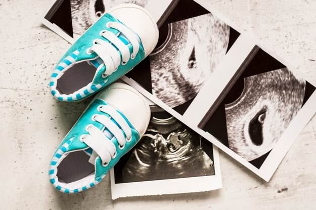 En Costa Rica, en los últimos 14 años, se registran 4.387 muertes gestacionales, perinatales y neonatales. Solo en tiempos de pandemia (años 2020 y lo que vamos del 2021) han fallecido 457 bebitos -252 en el 2020-), según el Instituto Nacional de Estadística y Censos (INEC)