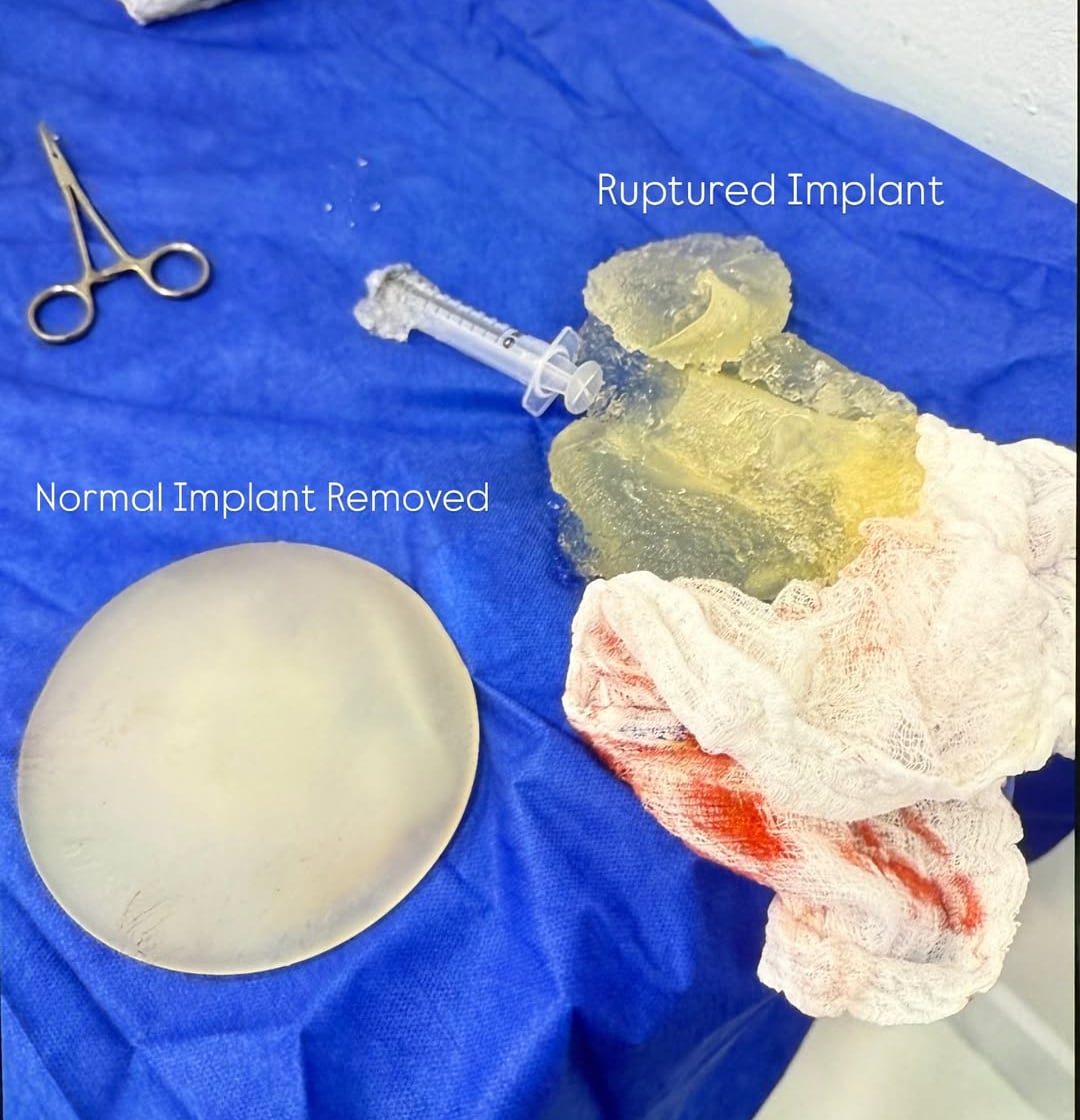 Linda Liz Watkins, la hija mayor de Lynda Díaz