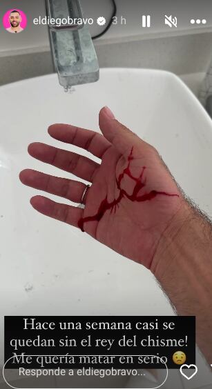 Diego Bravo mostró como le dejó el gato su mano.