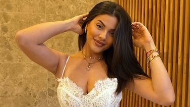 Laura Ortega sufrió un doloroso accidente y agradeció que a su cara no le pasó nada