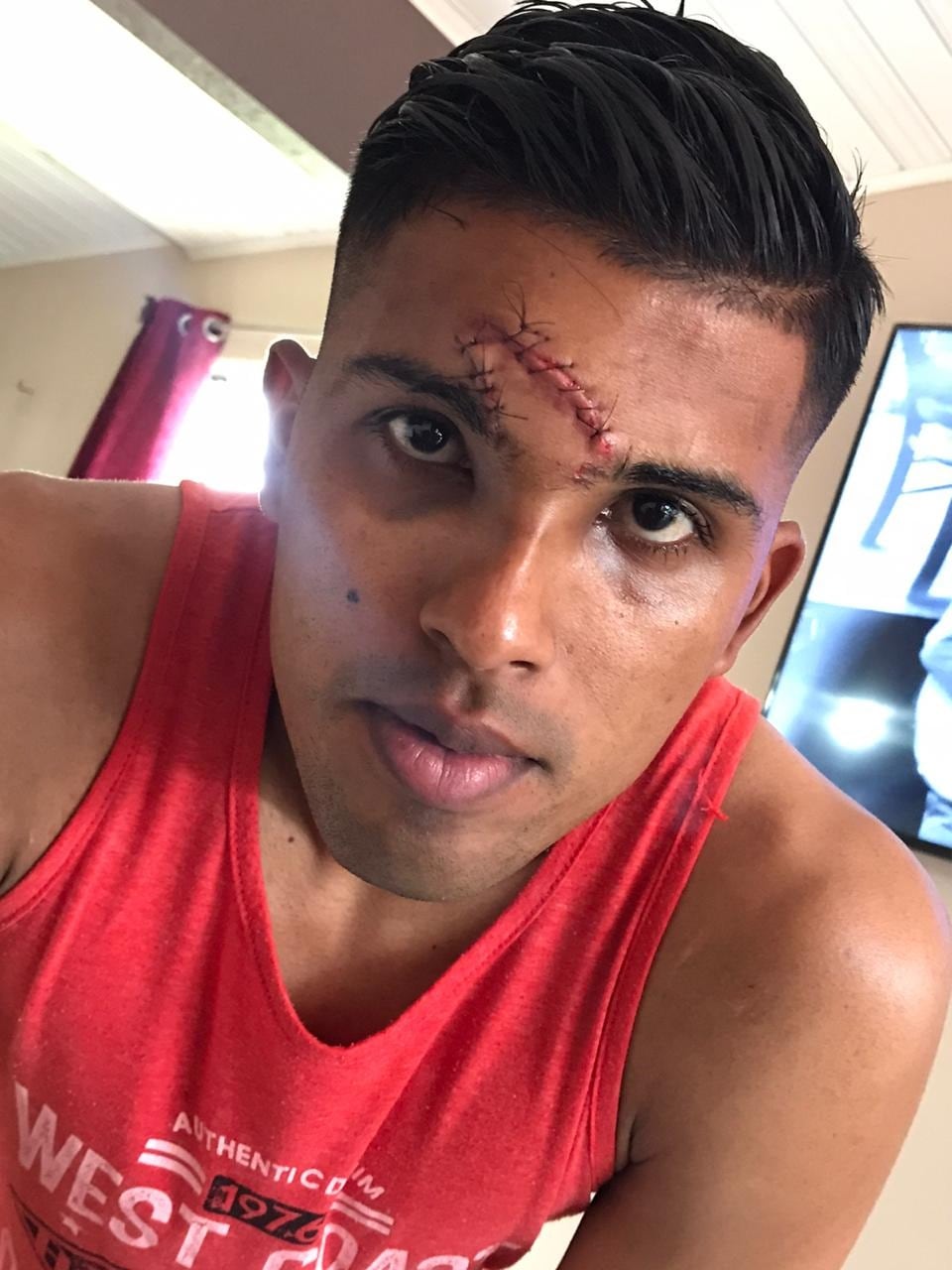 Bryan Morales, jugador de PZ que se lesionó el domingo.