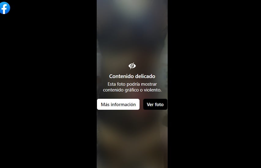 Al zaguatico Duke, símbolo del maltrato animal desde el 2016, se le desarrolló epilepsia, confirmaron los especialistas de la veterinaria Neurovet, después de varios exámenes que le realizaron