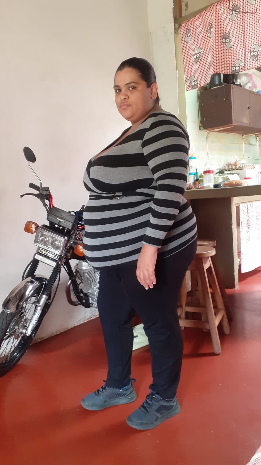 Mamá de tres hijas perdió 50 kilos en seis meses y cuando fue al hospital le diagnosticaron cáncer con metástasis
