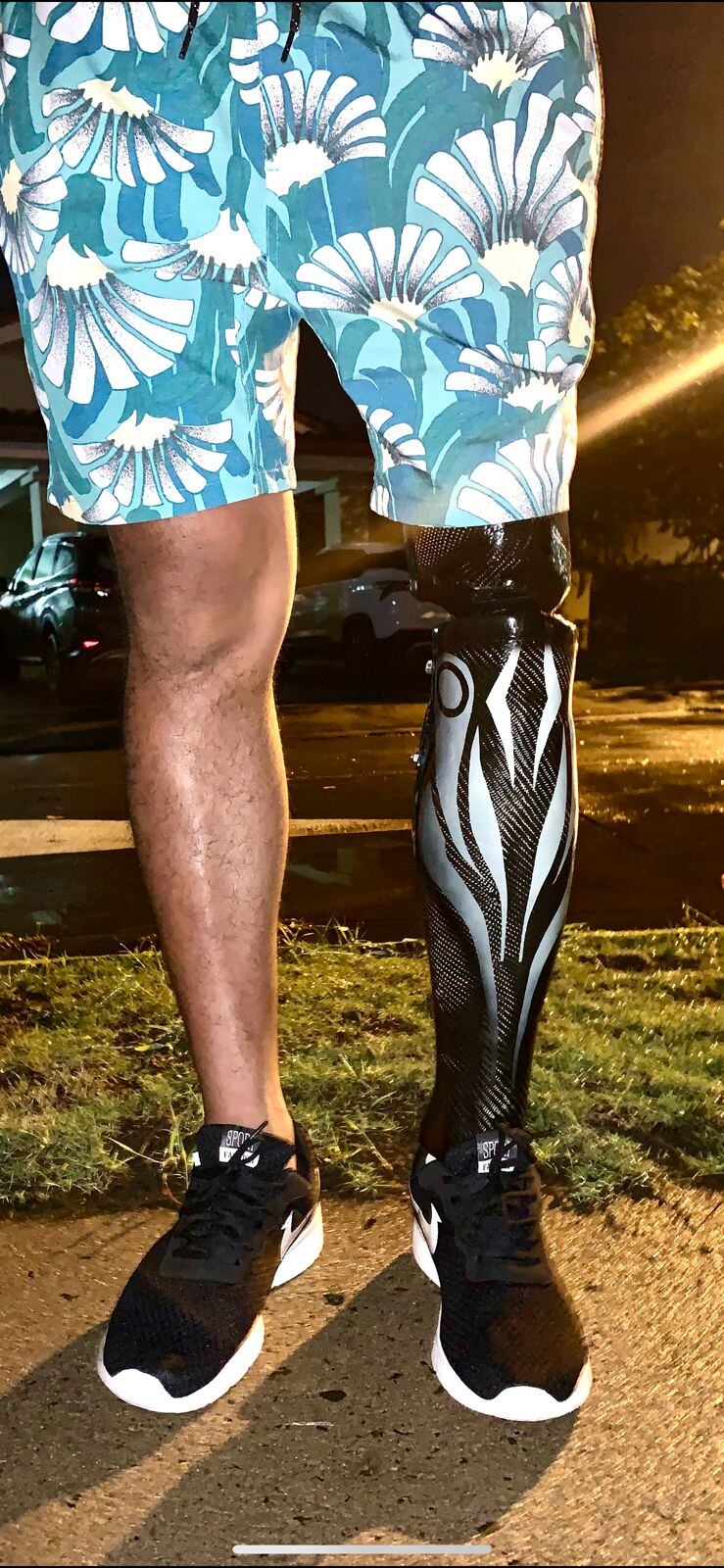 Yeison Silva, de origen nicaragüense, fabrica prótesis para personas amputadas.