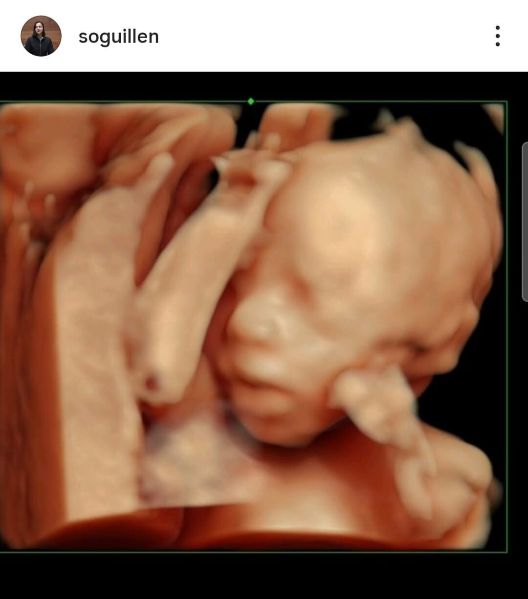 Sofía Guillén publicó una foto de su bebé