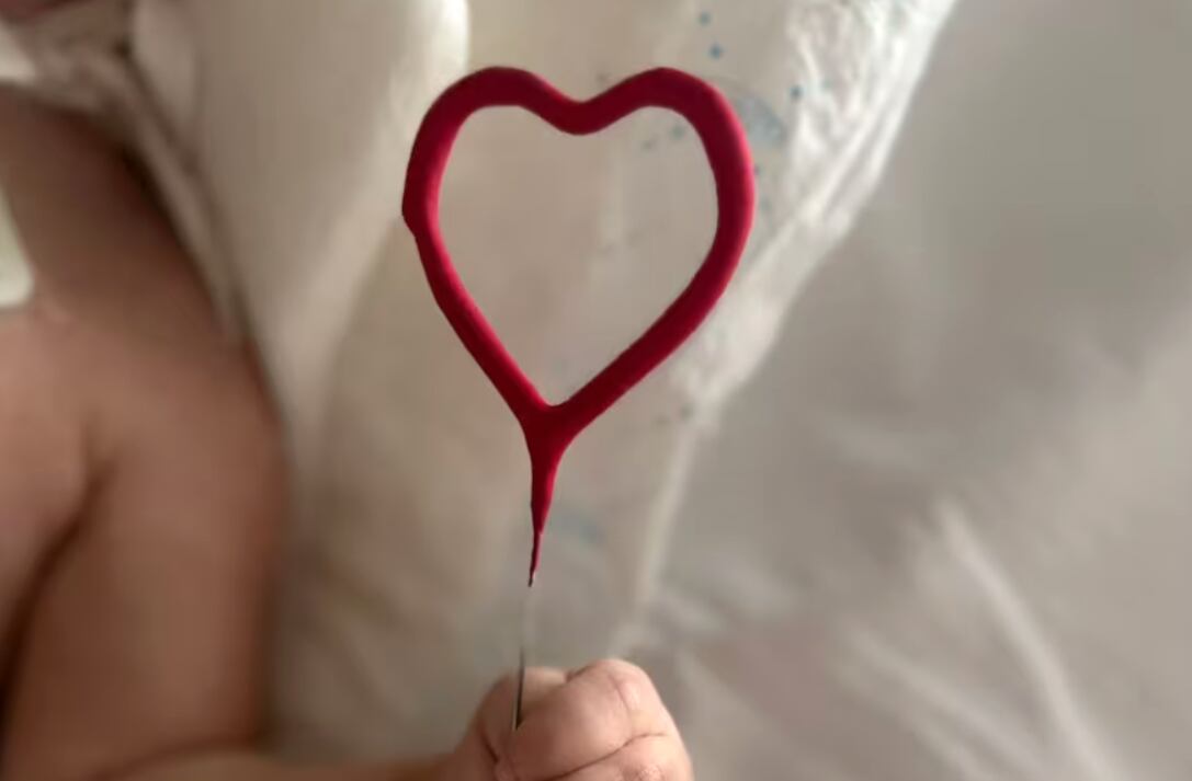 Dos niños compartían habitación en el hospital y uno terminó donándole el corazón al otro.