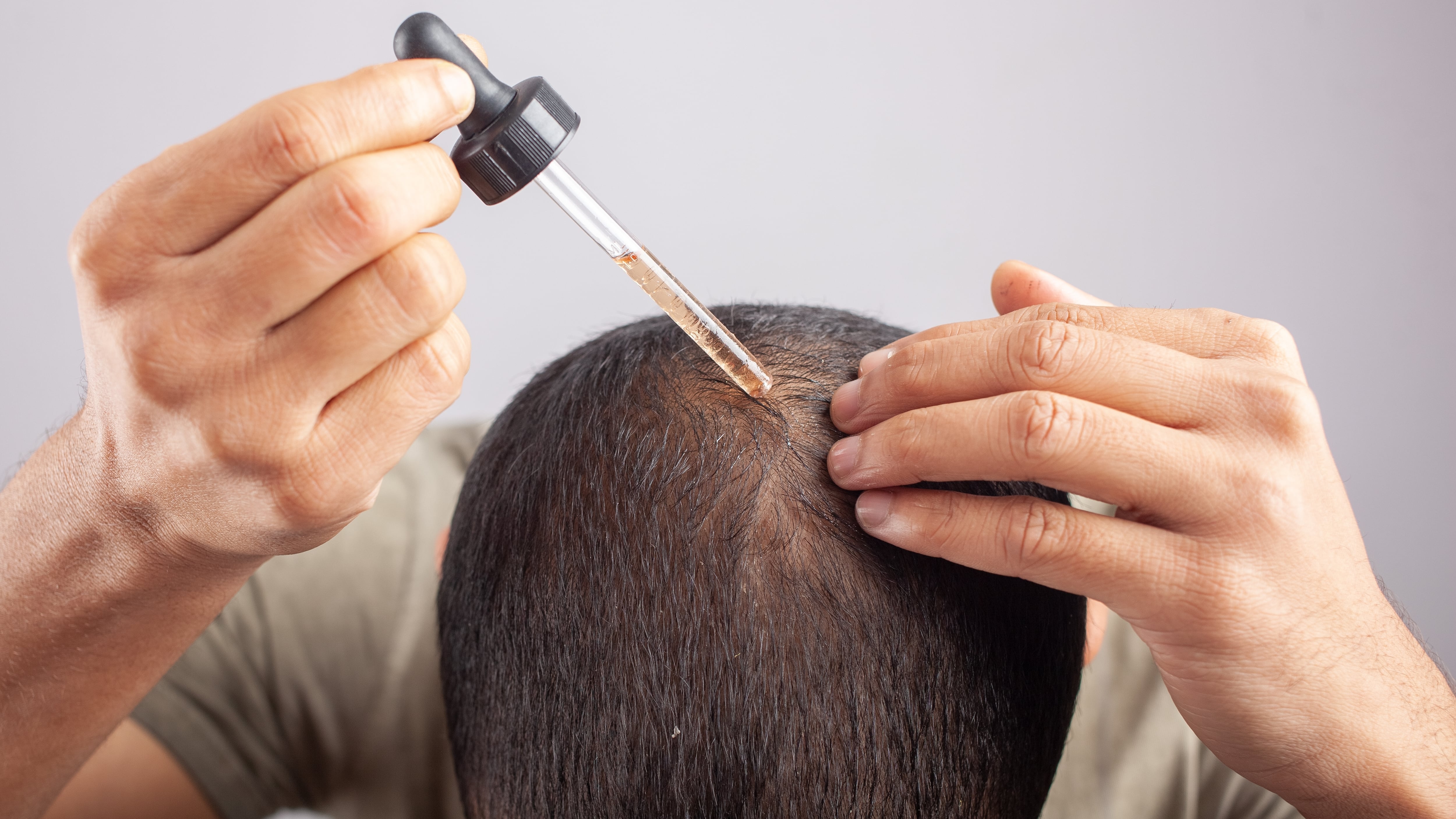 Minoxidil