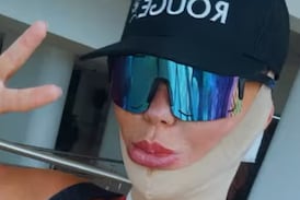 Modelo trans de Costa Rica, Vinna Rouge, se sometió a impactante cirugía estética que duró 14 horas